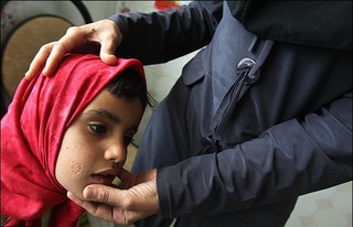 کاهش ۷۰ درصدی بیماری سالک در اصفهان