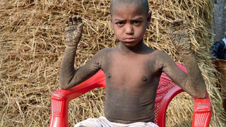 «کودک سنگی» روستایی را در بنگلادش به وحشت انداخت + تصاویر