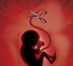 47 هزار مراجعه سقط جنین از 85 تا 94/ناباروری در زنان مشکل عمده سقط جنین