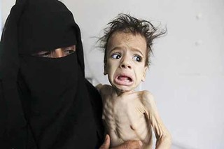 هشدار سازمان ملل درباره قحطی و فاجعه انسانی در یمن