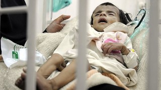 هزار و ۶۱۴ نفر از شهروندان یمنی بر اثر بیماری «وبا» جان باخته اند
