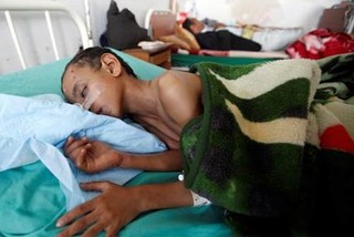 شمار قربانیان وبا در یمن به ۲ هزار نفر رسید/۵۰۰ هزار مورد ابتلا
