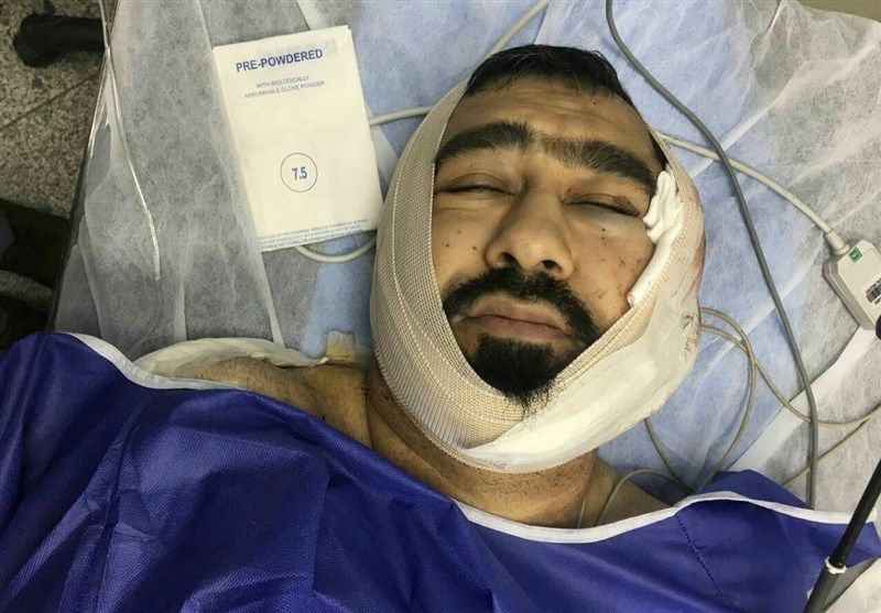 آخرین وضعیت "طلبه‌ تهرانی" که با ضربات قمه یک اوباش مجروح شد + تصاویر
