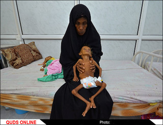 فاجعه انسانی در یمن / عکسهای دریافتی