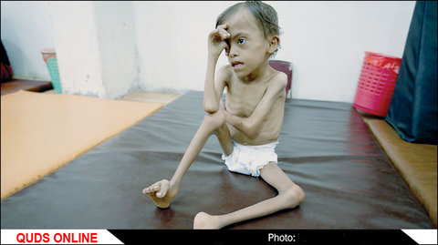 فاجعه انسانی در یمن