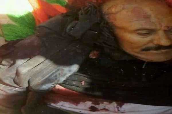 جسد عبدالله صالح به بیمارستان صنعا منتقل شد
