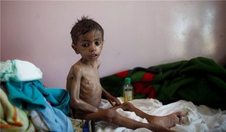 گزارش سازمان ملل: عربستان از گرسنگی در یمن به عنوان ابزار چانه‌زنی استفاده می‌کند
