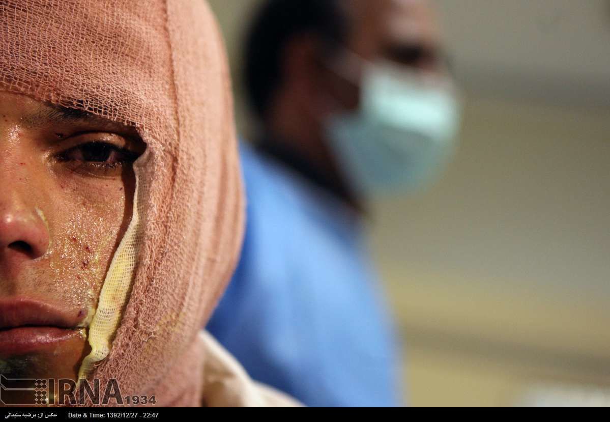 انفجار مواد محترقه جوان ۱۹ ساله مشهدی را راهی بیمارستان کرد
