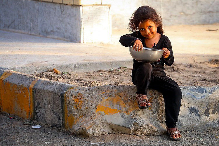 ۱۹ هزار کودک در کرمان سوء تغذیه دارند