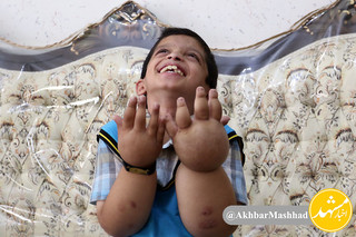 پسرمشهدی که به بیماری غیر قابل درمان لبخند می زند
