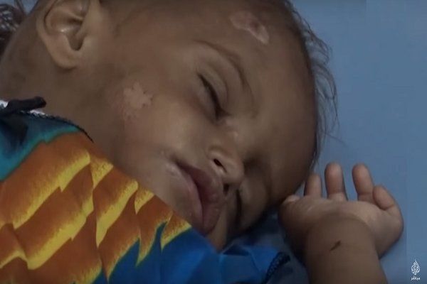 وضعیت انسانی در الحدیده یمن فاجعه بار است

