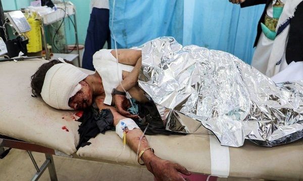 عربستان با بمب ساخت کدام کشور کودکان یمنی را به شهادت رساند؟
