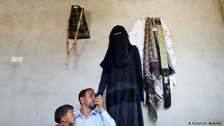 قطع دست، تنها راه نجات دختر یمنی