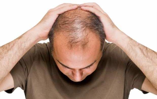 ریزش موهای خود را چگونه درمان کنیم؟