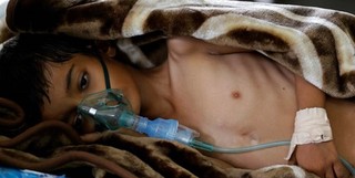 سکوت در برابر جنایات بن‌سلمان در یمن، خاشقچی را تکه‌تکه کرد