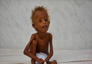 بیش از ۱۴ میلیون یمنی در معرض قحطی و گرسنگی 