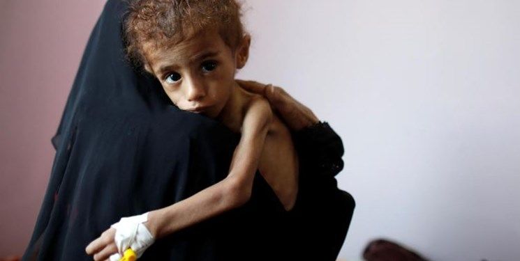 اظهارات تکان‌دهنده معاون دبیرکل سازمان ملل درباره "گرسنگی" میلیون‌ها یمنی