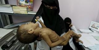 احتمال مرگ ۸۵ هزار کودک یمنی بر اثر گرسنگی و قحطی