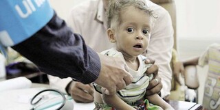 سازمان ملل: سال ۲۰۱۸ ،چهارصد نفر در یمن قربانی "وبا " شدند