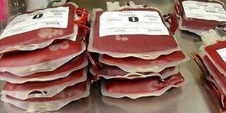 سالانه ۱۱۰۰ پیوند سلول‌های خون‌ساز در کشور انجام می‌شود