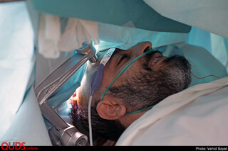 انجام موفق عمل جراحی مغز و اعصاب  بدون بیهوشی در بیمارستان رضوی مشهد