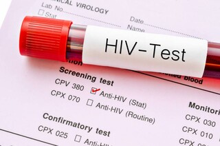 تست اچ آی وی HIV