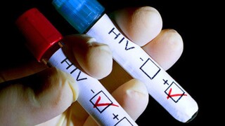 آزمایش HIV ایدز