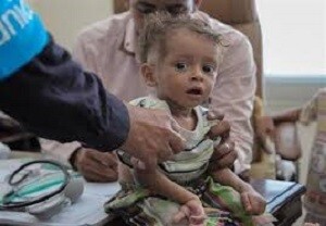 بانک جهانی: ۷۰ درصد جمعیت یمن در خطر گرسنگی قرار دارند