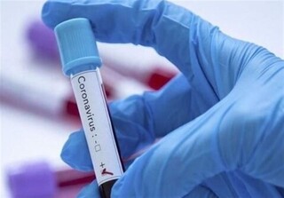 جواب آزمایش ۶۸ بیمار مشکوک به کرونا در نیشابور مثبت اعلام شد