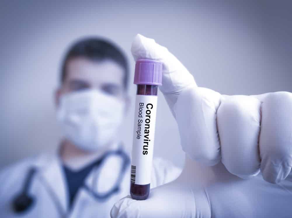 افزایش ظرفیت تشخیصی کشور در زمینه کرونا ویروس
