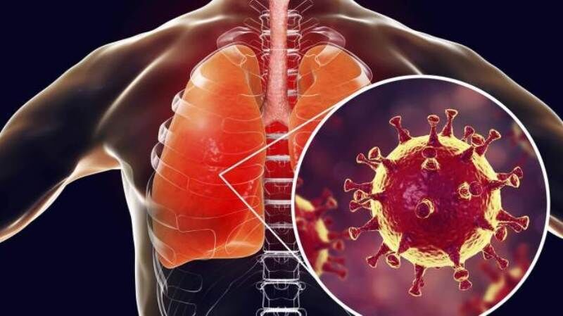 صدها بیمار عفونت حاد تنفسی در خراسان رضوی درمان شده‌اند