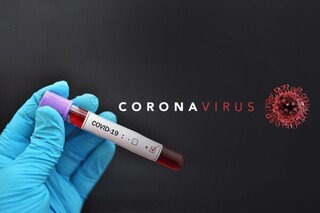 آمار مبتلایان به کرونا ویروس با شیب ملایم در حال افزایش است 
