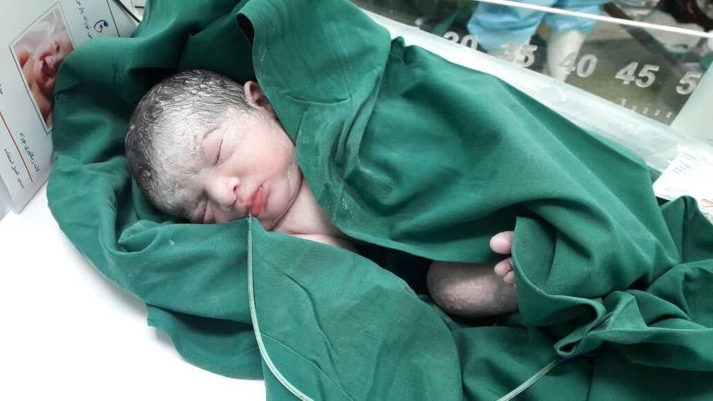 تولد نخستین نوزاد سبزواری از مادر مبتلا به کرونا
