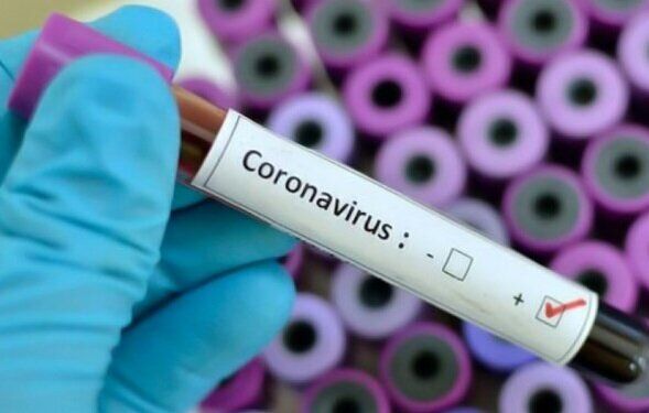 آزمایش ویروس کرونا از چه افرادی گرفته می شود؟