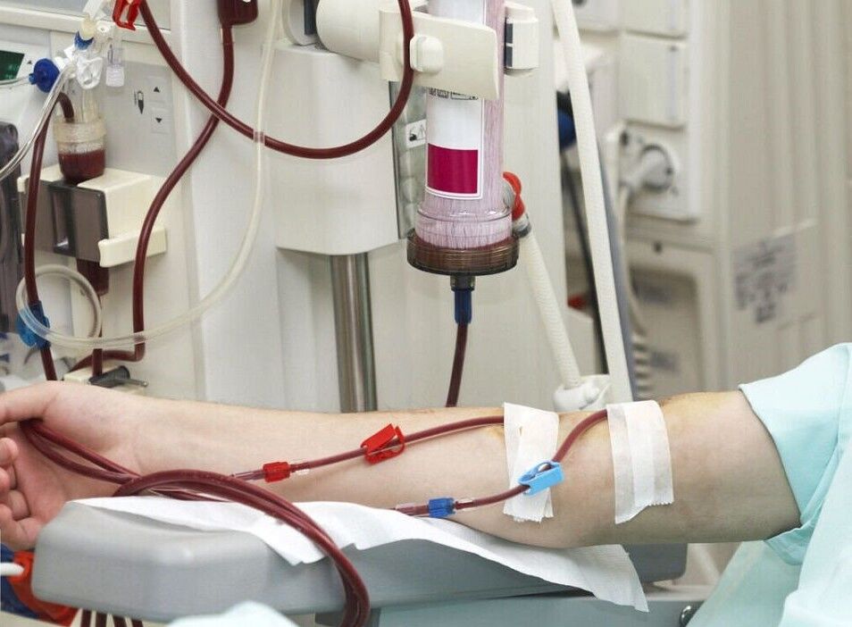 انجام ۲ هزار نوبت دیالیز بیماران کرونایی در بیمارستان شریعتی مشهد