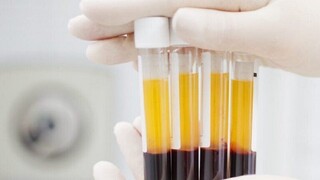 اهدای بیش از ۷۰۰ مورد پلاسمای خون در خراسان رضوی