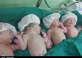 تولد نوزادان 4 قلو در مشهد/ آستان قدس هزینه‌ها را متقبل شد
