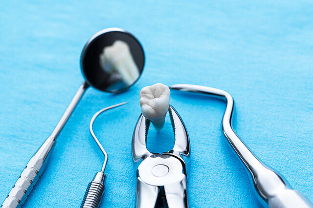 کشیدن دندان عقل موجب بهبود عملکرد چشایی می‌شود
