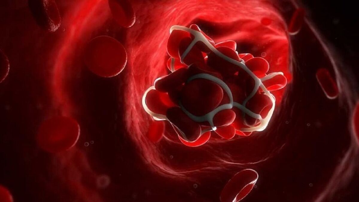 شناسایی پروتئین مهمی که از لخته شدن خون کشنده پیشگیری می‌کند