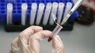 درمان اچ آی وی با سلول بنیادی