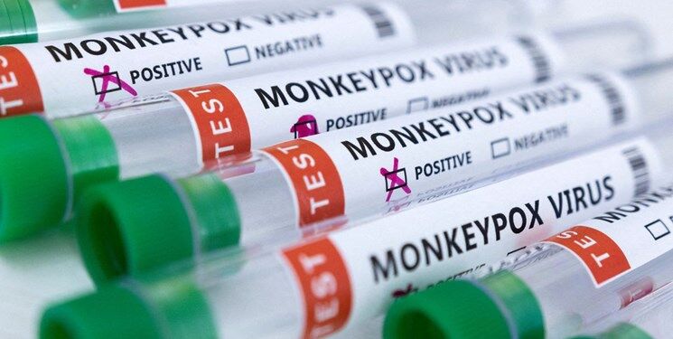  رقابت شرکت‌های جهان برای ساخت کیت‌های تشخیص آبله میمون 