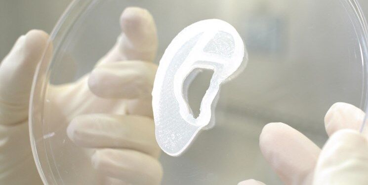  برای اولین بار در جهان: پیوند گوش چاپ سه بعدی به انسان 