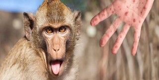 ردپای آبله میمونی در ۱۰۵ کشور دنیا