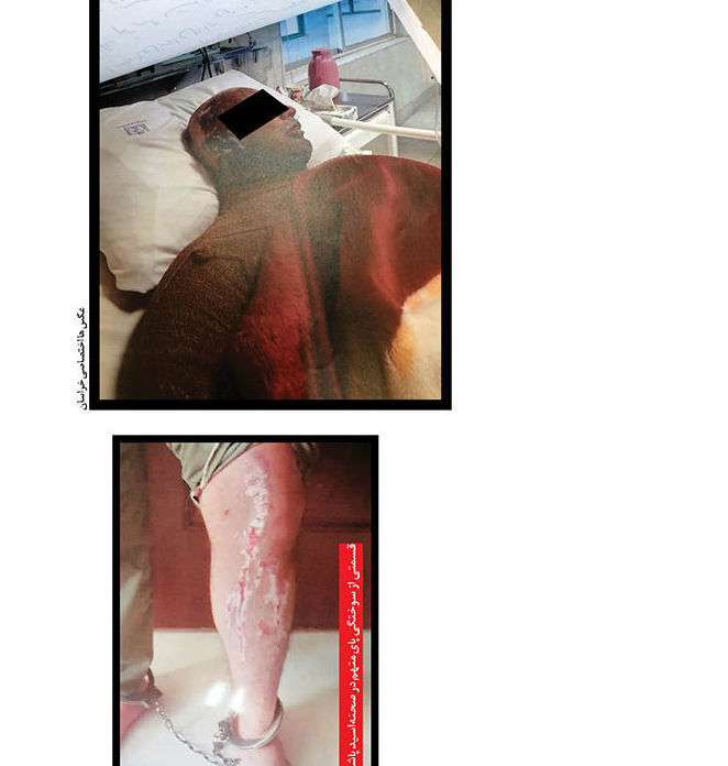 اسیدپاشی بادیگاردهای کمدین ایرانی روی یک مرد ! + عکس