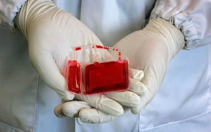 افزایش ۱۵ درصدی ذخیره خون بندناف در ایلام