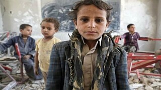 کشته یا زخمی شدن بیش از ۸ هزار کودک یمنی