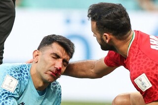 واکنش عجیب رسانه انگلیسی؛ احتمال ضربه مغزی دروازه‌بان ایران!