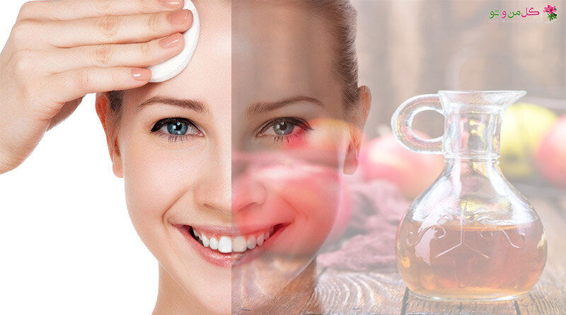 حفظ سلامتی پوست با این روشهای ساده