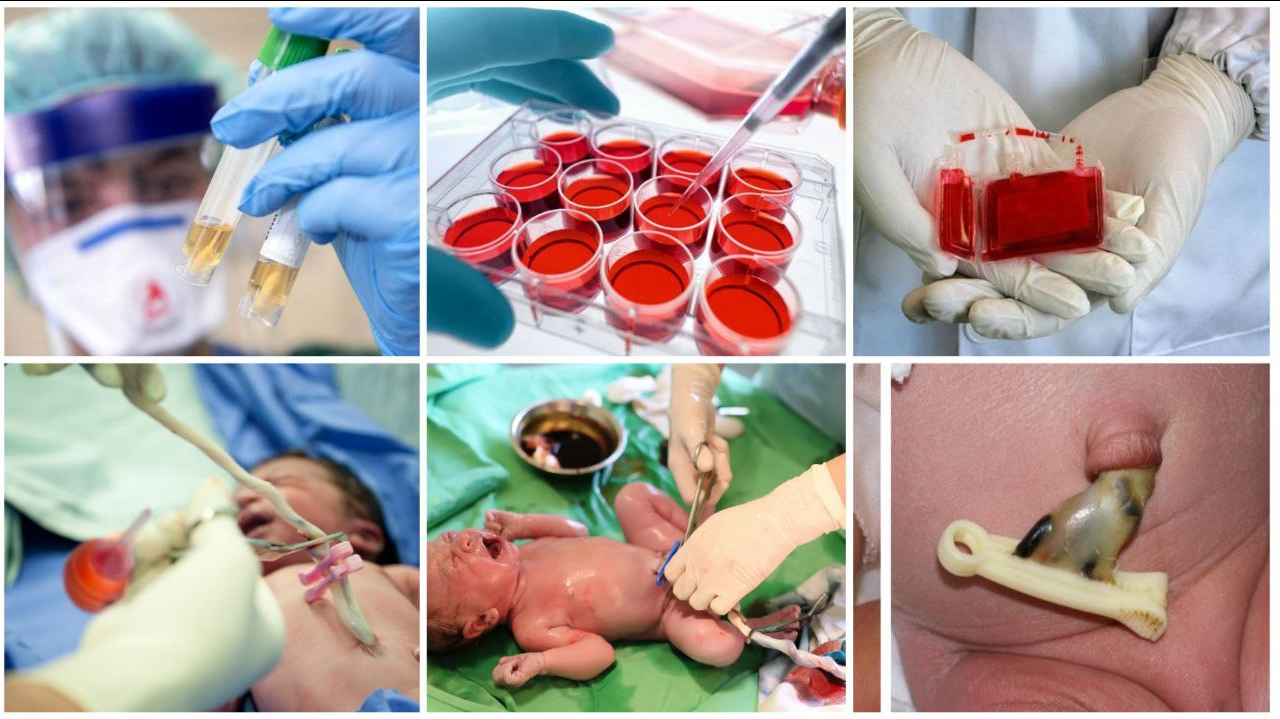 ضرابی: هدفمان راه اندازی اولین پالایشگاه محصولات ضمائم زایمانی است/بند ناف، زباله بیولوژیکی که دور ریختنی نیست!