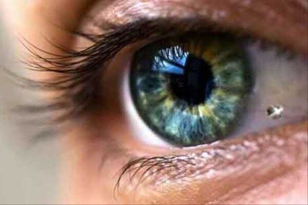 عوارض خطرناک کاشت نگین و تغییر رنگ چشم
